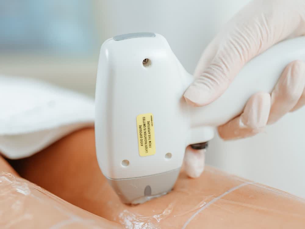 Laser Treatments