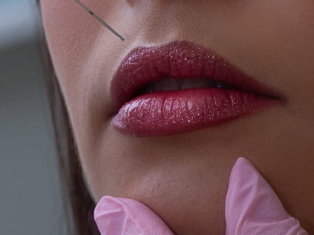 Lip Enhancement