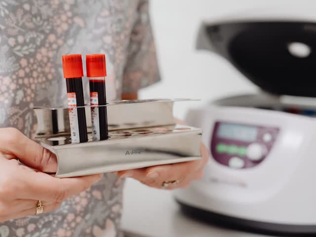 PRP (Platelet-Rich Plasma) treatment at Aterna Wellness