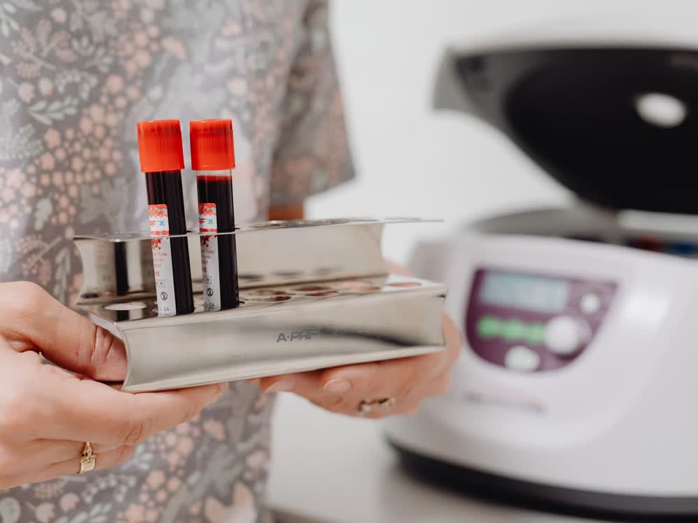 PRP (Platelet-Rich Plasma) at Aterna Wellness